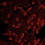 OPRM1 Antibody in Immunohistochemistry (IHC)