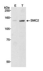 SMC2 Antibody in Western Blot (WB)