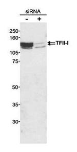 GTF2I Antibody in Western Blot (WB)
