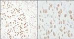 CA150 Antibody in Immunohistochemistry (Paraffin) (IHC (P))