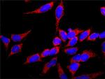 FGFR1 Polyclonal Antibody