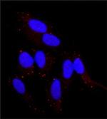 FGFR2 Polyclonal Antibody