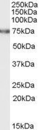FEM1A Polyclonal Antibody