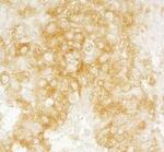 DIAPH1 Antibody in Immunohistochemistry (Paraffin) (IHC (P))