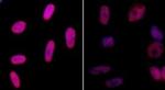 Phospho-Histone H2A.X (Ser139) Antibody in Immunocytochemistry (ICC/IF)