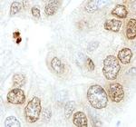 Phospho-Histone H2A.X (Ser139) Antibody in Immunohistochemistry (Paraffin) (IHC (P))