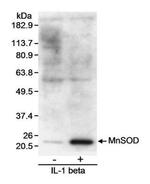 SOD2 Antibody in Western Blot (WB)