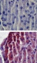 TLR2 Polyclonal Antibody