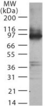 TLR2 Antibody in Western Blot (WB)