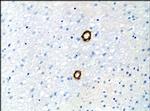 ASAP1 Antibody in Immunohistochemistry (Paraffin) (IHC (P))