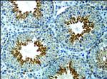 ASAP1 Antibody in Immunohistochemistry (Paraffin) (IHC (P))