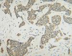 FGF10 Antibody in Immunohistochemistry (Paraffin) (IHC (P))