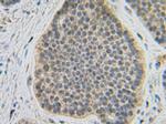 FGF10 Antibody in Immunohistochemistry (Paraffin) (IHC (P))