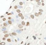 SP1 Antibody in Immunohistochemistry (Paraffin) (IHC (P))