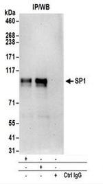 SP1 Antibody in Immunoprecipitation (IP)