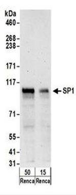 SP1 Antibody in Western Blot (WB)