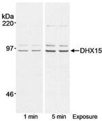 DHX15 Antibody in Western Blot (WB)