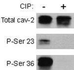 Phospho-Caveolin 2 (Ser23) Antibody in Western Blot (WB)