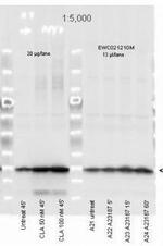 Phospho-MYL12A (Ser19) Antibody in Western Blot (WB)