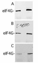 eIF4G Antibody in Western Blot (WB)
