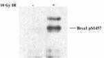 Phospho-BRCA1 (Ser1457) Antibody in Western Blot (WB)