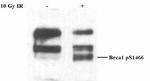 Phospho-BRCA1 (Ser1466) Antibody in Western Blot (WB)