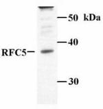 RFC5 Antibody in Western Blot (WB)