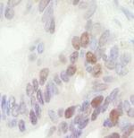 MCM4 Antibody in Immunohistochemistry (Paraffin) (IHC (P))