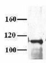 MCM10 Antibody in Western Blot (WB)