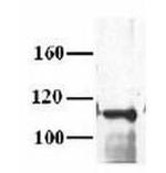 MCM10 Antibody in Western Blot (WB)