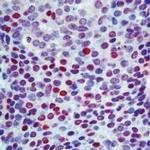 p57 Kip2 Antibody in Immunohistochemistry (IHC)