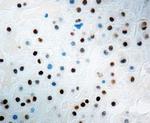 p57 Kip2 Antibody in Immunohistochemistry (IHC)