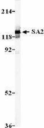 SA2 Antibody in Western Blot (WB)