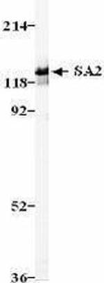SA2 Antibody in Western Blot (WB)