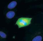 Phospho-MEK1/MEK2 (Ser221) Antibody in Immunohistochemistry (IHC)