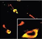 Phospho-EIF2S1 (Ser52) Antibody in Immunohistochemistry (IHC)