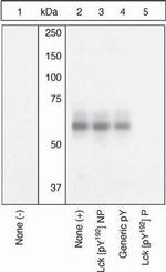 Phospho-LCK (Tyr192) Antibody in Western Blot (WB)