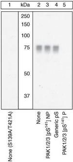 Phospho-PAK1/2/3 (Ser141) Antibody in Western Blot (WB)