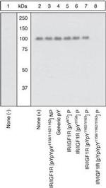 Phospho-IGF1R beta (Tyr1158, Tyr1162, Tyr1163) Antibody in Western Blot (WB)