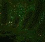 TNF alpha Antibody in Immunohistochemistry (IHC)