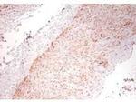 TNF alpha Antibody in Immunohistochemistry (PFA fixed) (IHC (PFA))