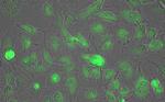 LDHA Antibody in Immunocytochemistry (ICC/IF)