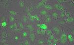 LDHA Antibody in Immunocytochemistry (ICC/IF)