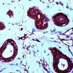 PDGF-B Antibody in Immunohistochemistry (IHC)