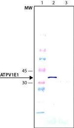 V-ATPase E1 Antibody in Western Blot (WB)