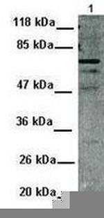 MDMX Antibody in Western Blot (WB)