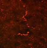 Prodynorphin Polyclonal Antibody