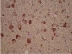 CK1 delta Antibody in Immunohistochemistry (Paraffin) (IHC (P))