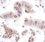 CoAA Antibody in Immunohistochemistry (Paraffin) (IHC (P))