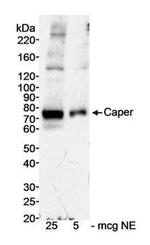 HCC1 Antibody in Western Blot (WB)